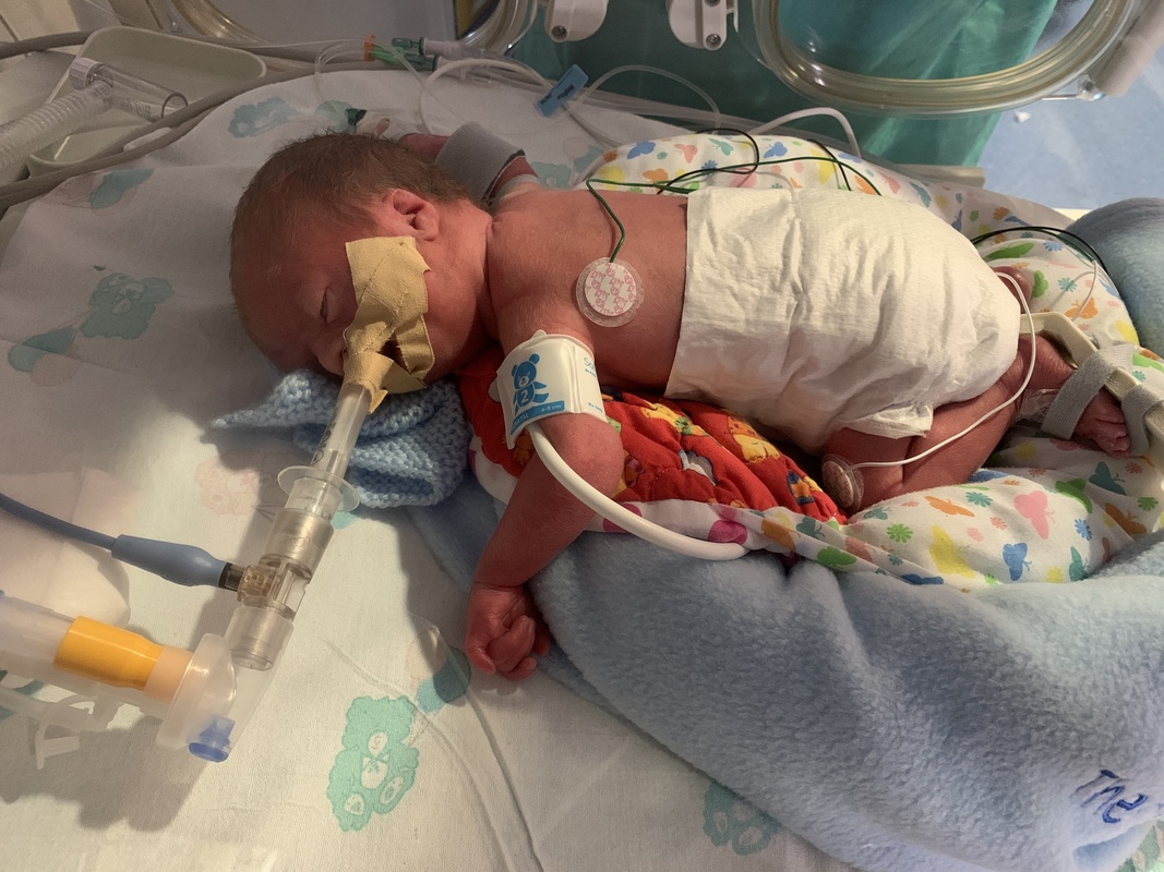 Managing the Difficult Airway in the Neonate British Association of