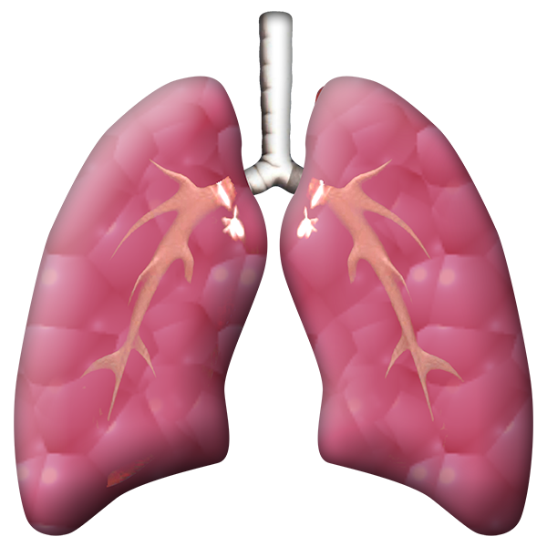 Lung and Breathing Problems (COPD) Easy Health