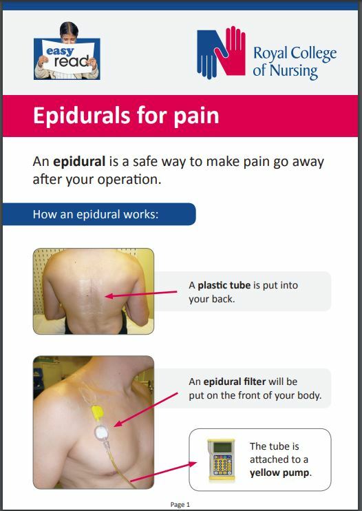 epidural site pain years later epidural site pain years later