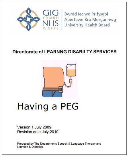 Having a PEG | Easy Health